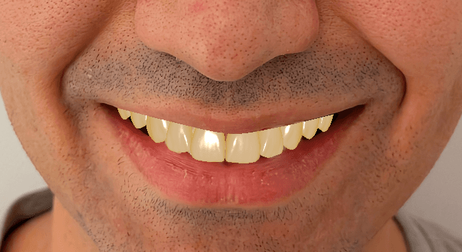 Digital Smile Design