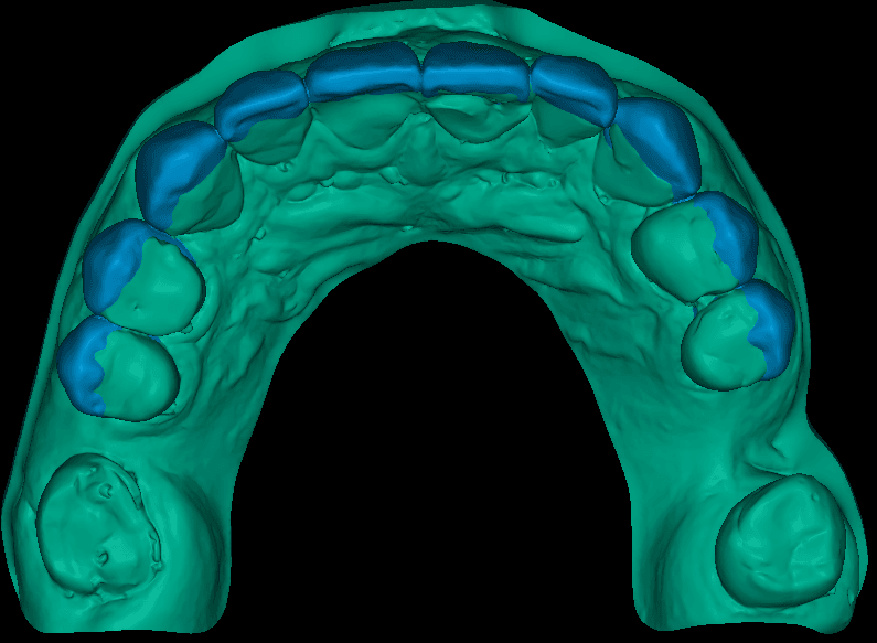 Digital Model & Diagnostic Mockup Design