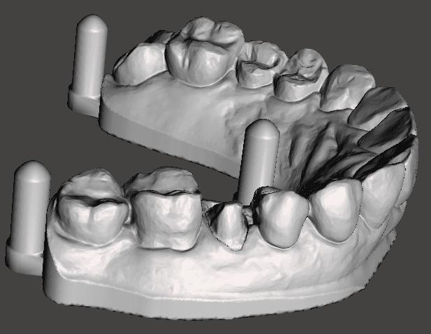 Digital Models